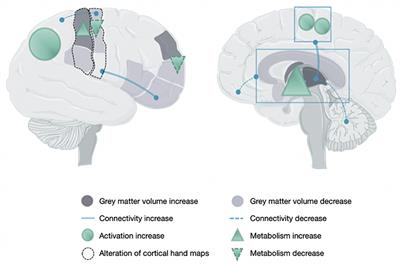 Complex Regional Pain Syndrome. A Comprehensive Review on Neuroplastic Changes Supporting the Use of Non-invasive Neurostimulation in Clinical Settings